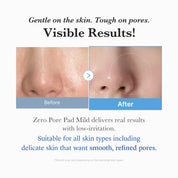 Zero Pore Pad Mild Medicube