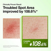 Serum Hyaluron Redness Soothing 10+ 30ml Anua