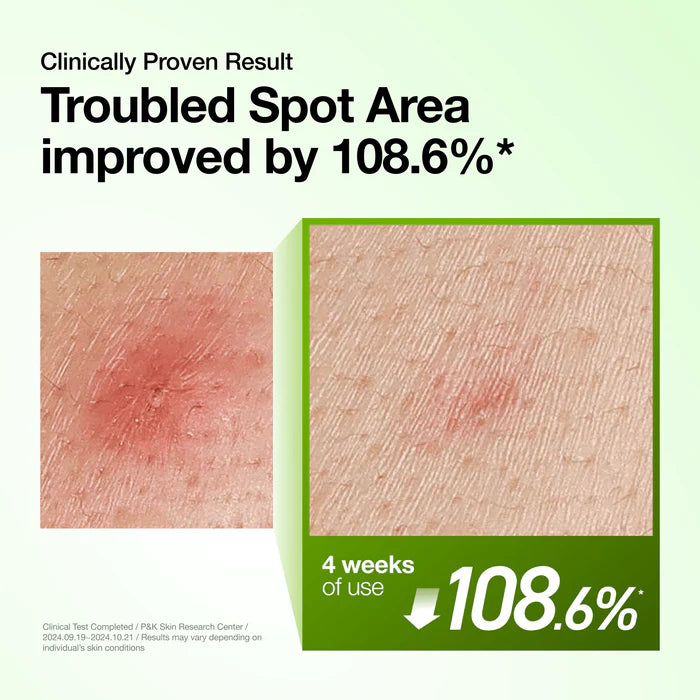 Serum Hyaluron Redness Soothing 10+ 30ml Anua