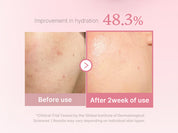 PDRN Pink Niacinamide Milky Toner Medicube