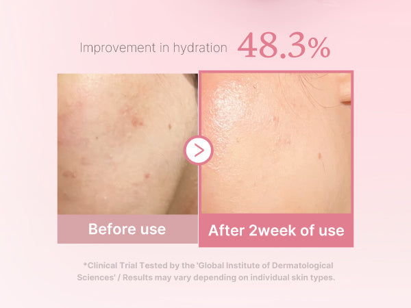 PDRN Pink Niacinamide Milky Toner Medicube